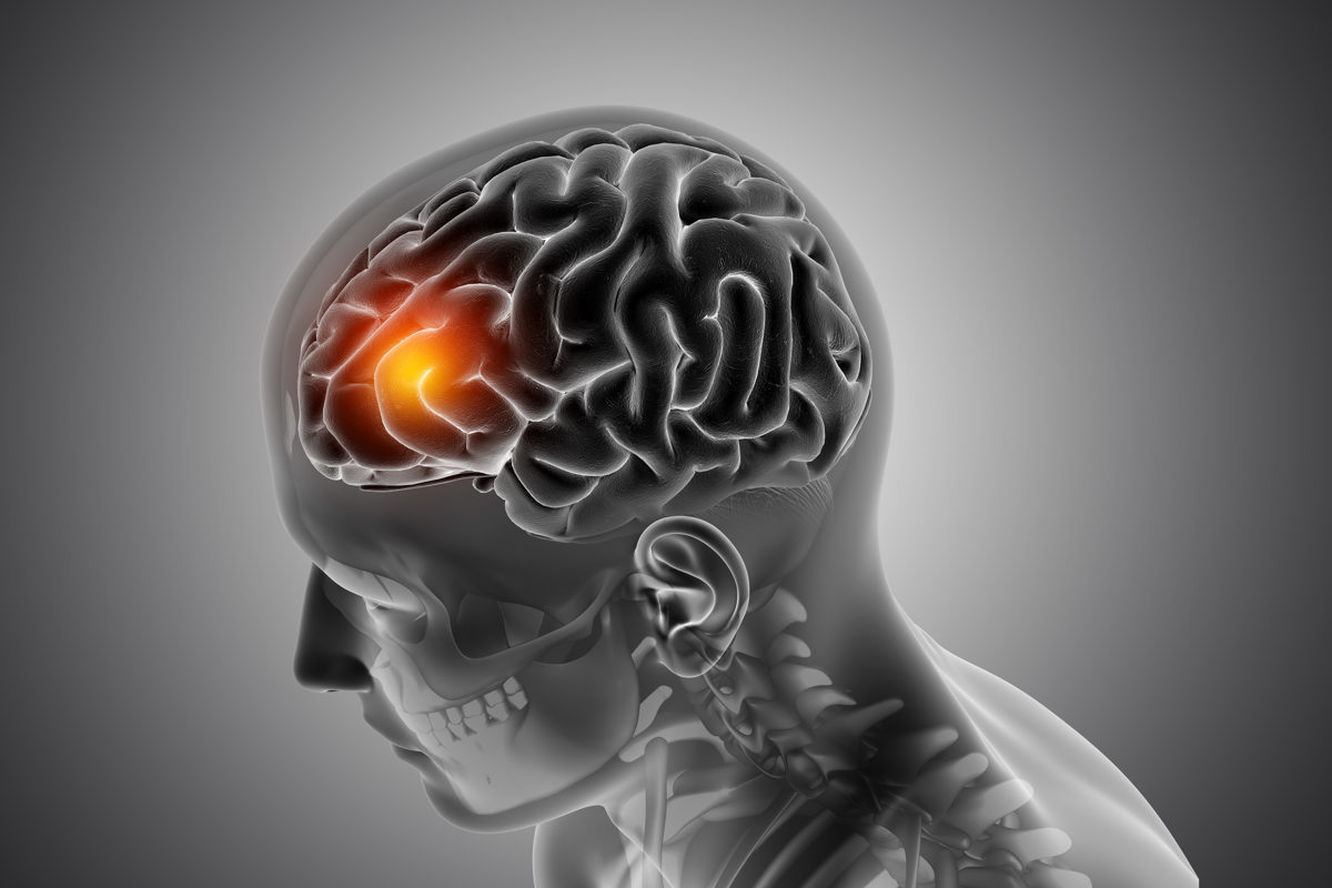 Peripheral Nerve Surgery